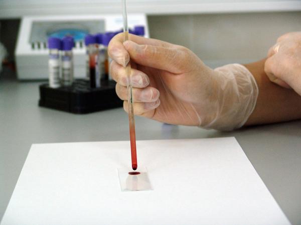 Allergitesting for hunder - Blodprøver